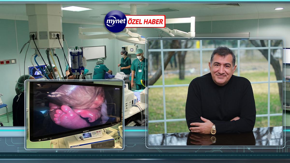 Fetal cerrahi