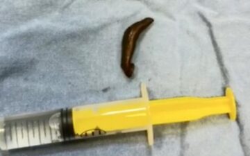 leech