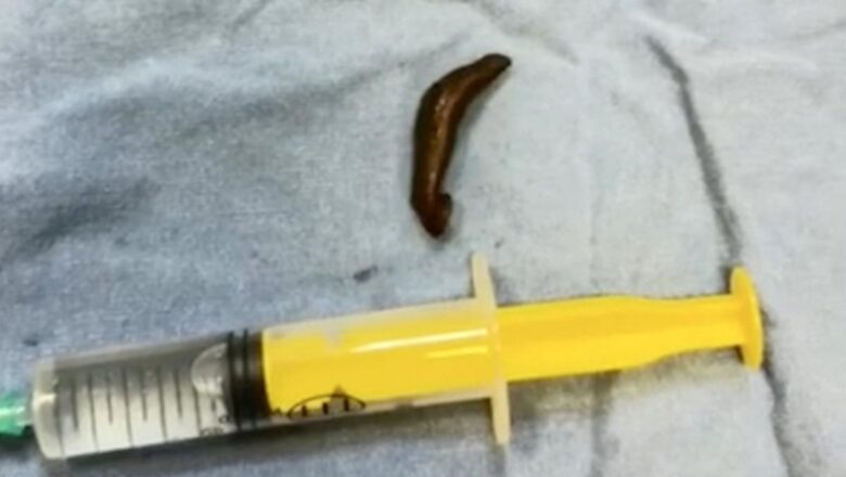 leech